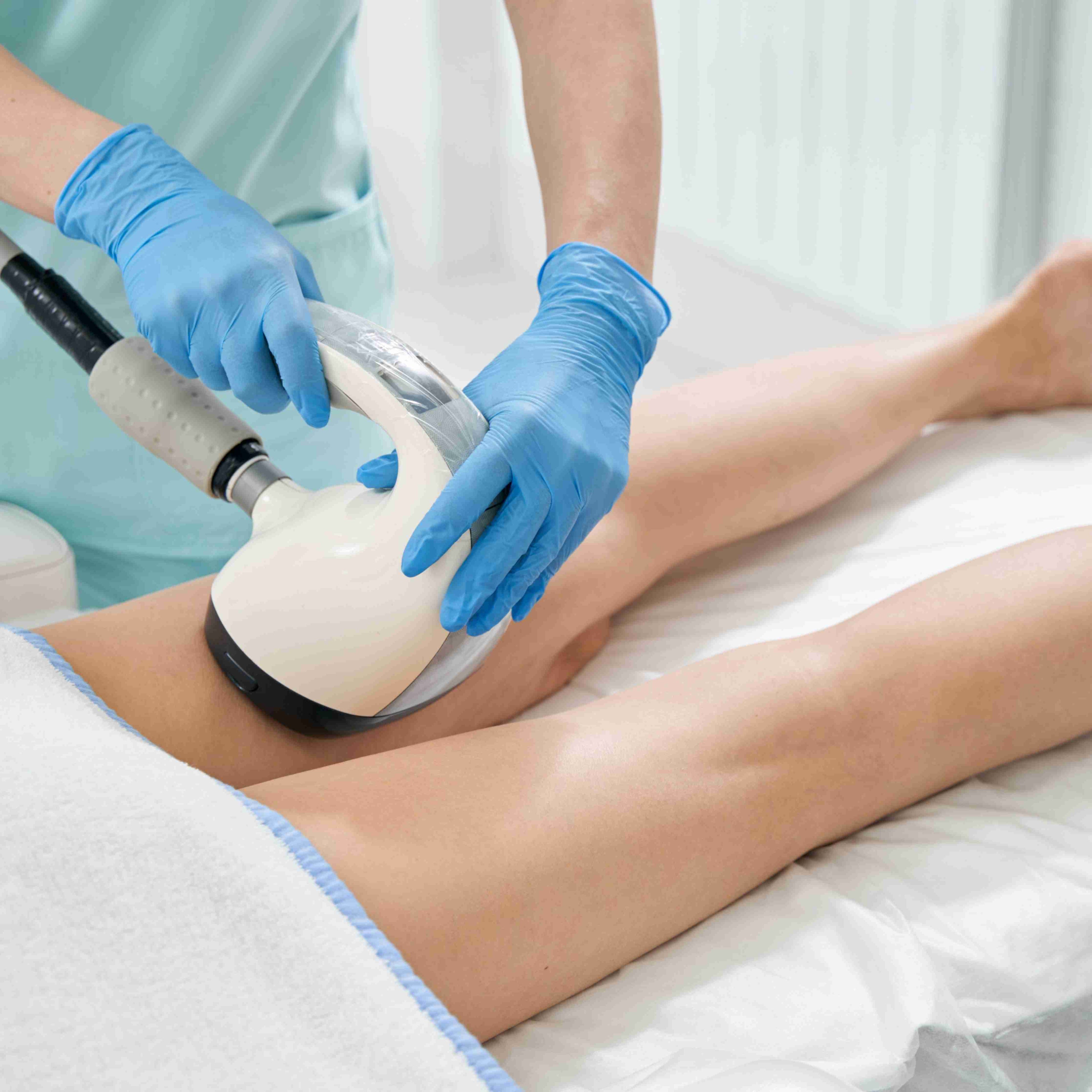 Ultrasculpt Cellulite Reduction